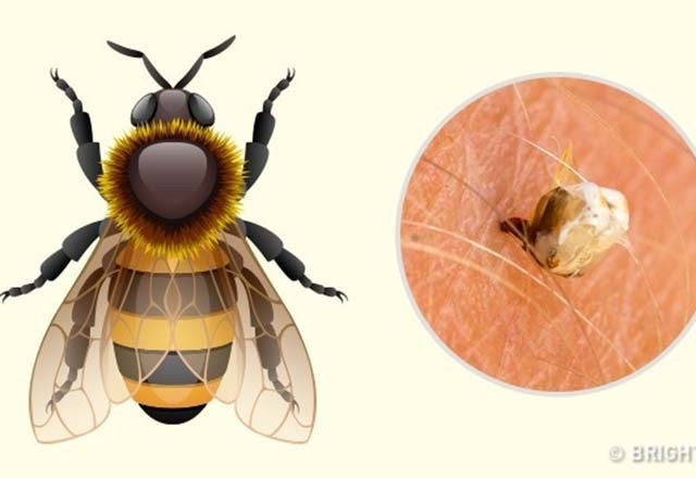 Bu böcek ısırıklarına dikkat! Hangileri tehlikeli - Resim: 3