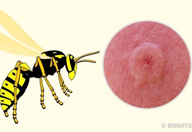 Bu böcek ısırıklarına dikkat! Hangileri tehlikeli - Resim: 4