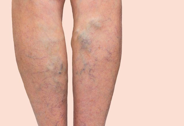 Ayakları buzlu suda bekletmenin faydaları neler? - Resim: 2