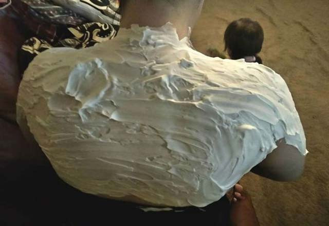 Sırtına tıraş köpüğü sürdü: Acılardan kurtuldu! - Resim: 3