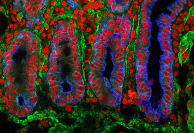 Gördüğünüz şeyin ne olduğunu öğrenince çok şaşıracaksınız! - Resim: 4