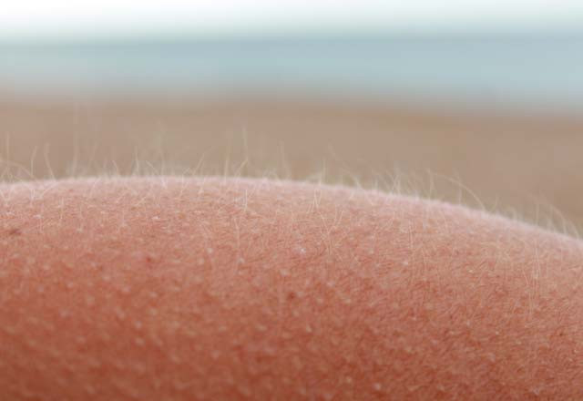 Tüylerimiz  neden diken diken olur? - Resim: 1