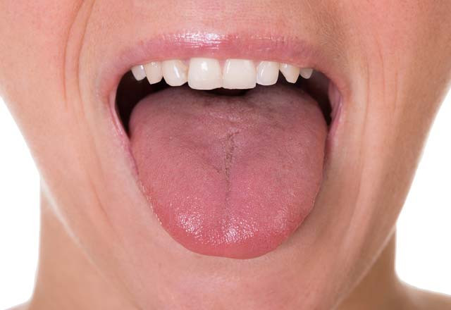 Tüylerimiz  neden diken diken olur? - Resim: 4