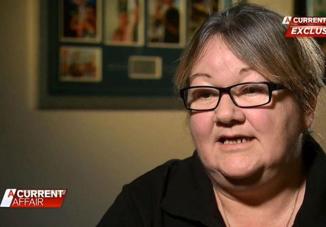 Güzelleşmek isterken parmağından oldu - Resim: 2