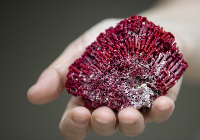 Panik atak için kardeş kanı içti entübe edildi - Resim: 0