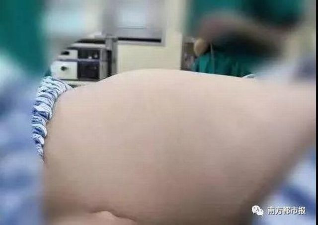 Karın ağrısıyla hastaneye kaldırıldı midesinden çıkanlar şoke etti - Resim: 2