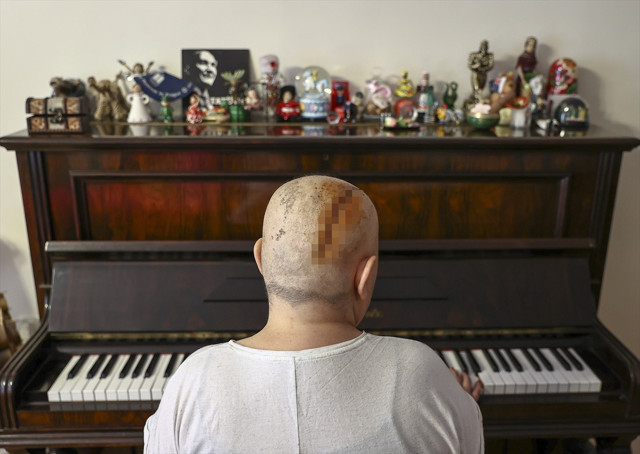 Azmi tüm kanser hastalarına umut olur 9 kez kanseri atlattı - Resim: 1