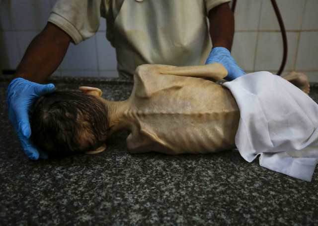 İnsanlıktan utandıran görüntüler! Gazzeli Hikmet, yetersiz beslenme nedeniyle öldü - Resim: 2