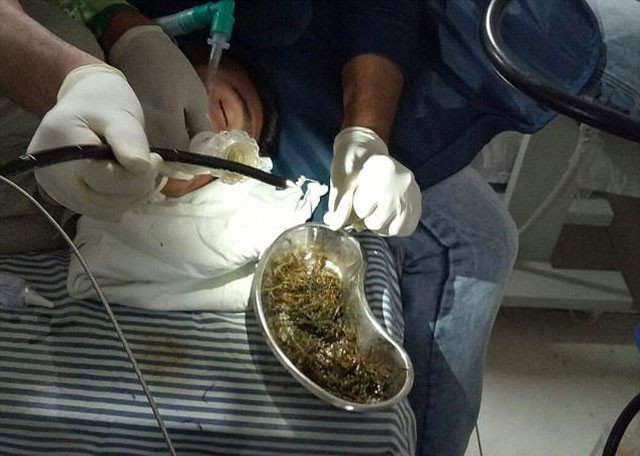 Karın ağrısı nedeniyle hastaneye kaldırıldı içinden bakın ne çıktı - Resim: 4