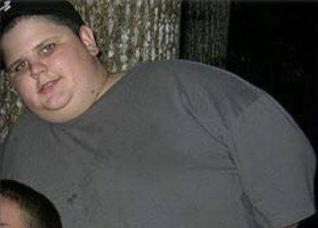 O kadar çok kilo verdi ki kimse onu tanıyamadı - Resim: 1