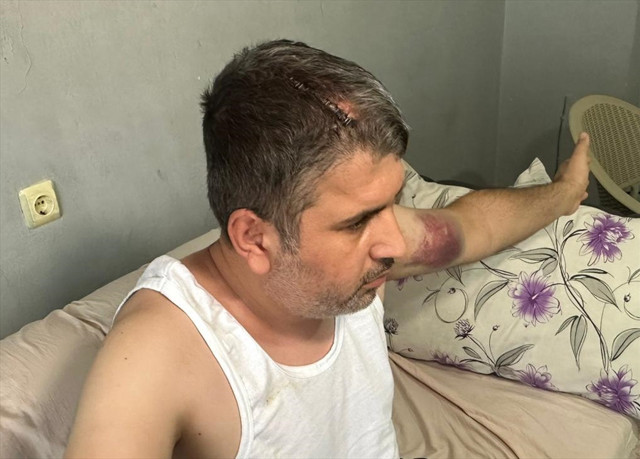 Yeğenini beyzbol sopasıyla bu hale getirdi! Acımasız dayı tutuklandı - Resim: 0