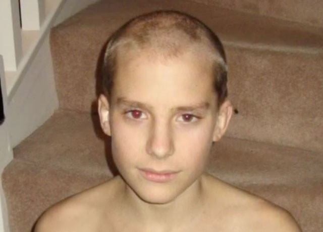 Kanserli ikizinin acılarını hissetti tıp dünyası şokta! - Resim: 3