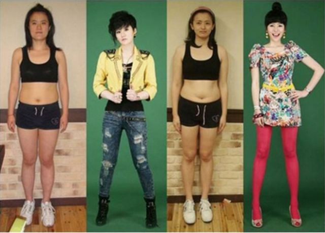 Korelilerin inanılmaz estetik çılgınlığı - Resim: 1