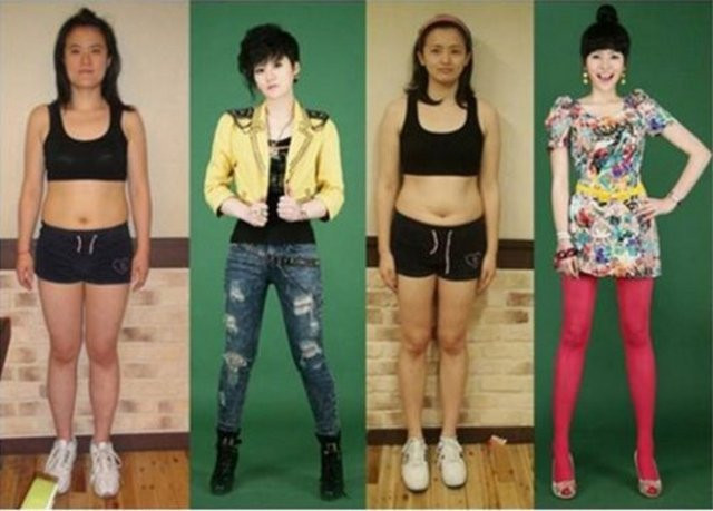 Koreliler'in estetik çılgınlığı - Resim: 1