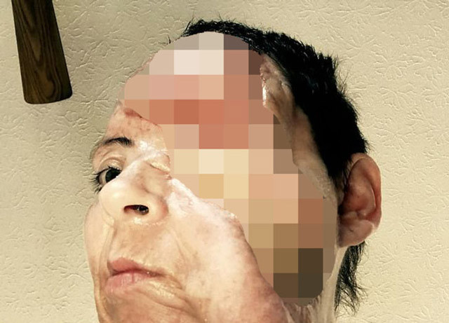 Yüzünde havai fişek patladı! Hayatı bir günde karardı - Resim: 1