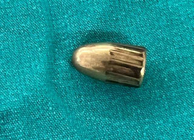 Annesi arı soktu sandı oğlunu hastaneye götürdü gerçek başka çıktı - Resim: 0