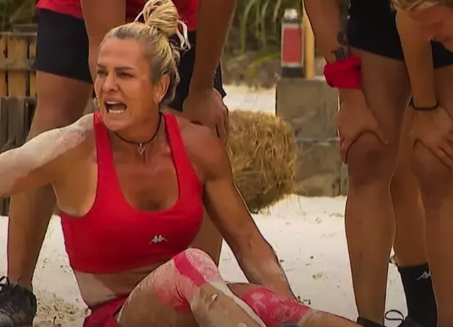 Survivor Nagihan'ın o halleri yürekleri burktu! Sedyedeki fotoğrafı herkesi üzdü - Resim: 0