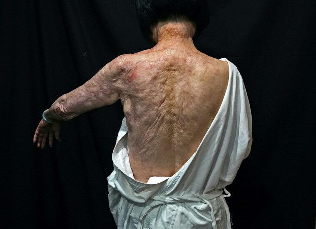 Vietnam savaşında tarihi fotoğrafı çeken muhabirden Gazze açıklaması - Resim: 2