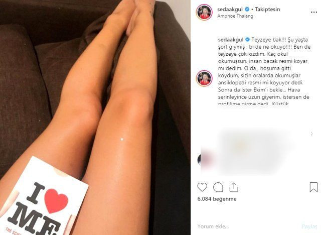 Seda Akgül paylaştığı bacak fotoğrafıyla olay oldu - Resim: 3