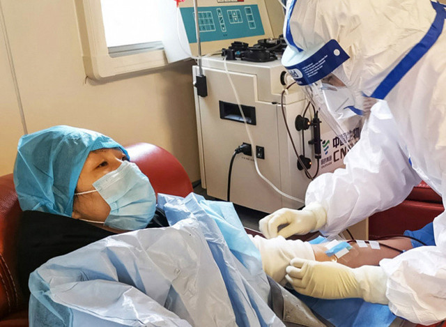 Korona ne demek? Profesör açıkladı en çok bakın kimleri öldürüyor - Resim: 1