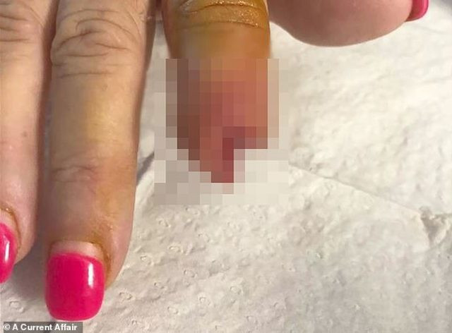 Güzelleşmek isterken parmağından oldu - Resim: 1