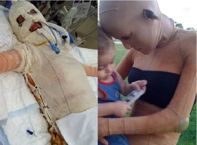 Kıskanç kadın yüzünü bu hale getirdi - Resim: 1