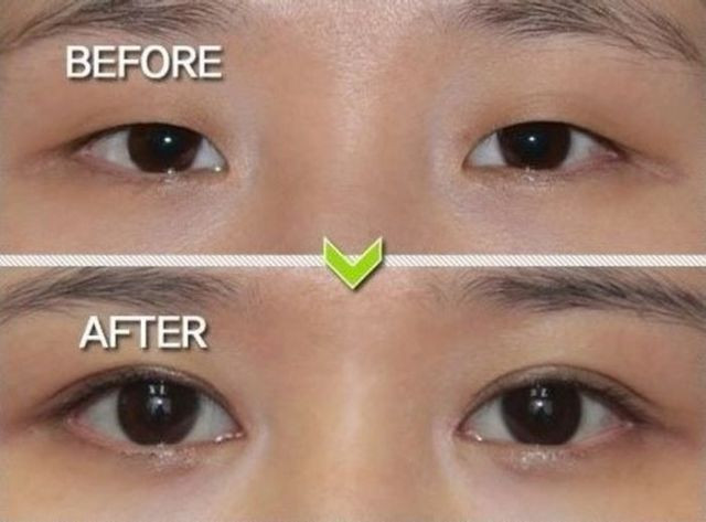 Korelilerin inanılmaz estetik çılgınlığı - Resim: 4