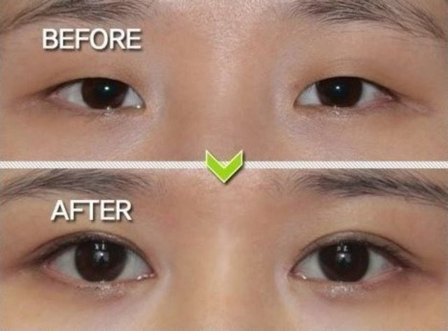 Koreliler'in estetik çılgınlığı - Resim: 4