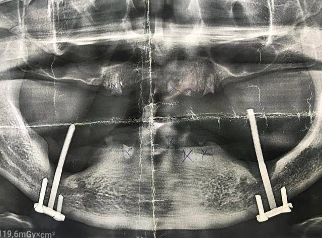 28 yıl sonra öğrendi! Görünce doktorlar bile şoke oldu - Resim: 2