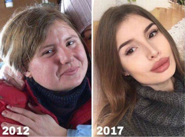 Aynı kişi olduğuna inanmakta zorluk çekeceksiniz - Resim: 3