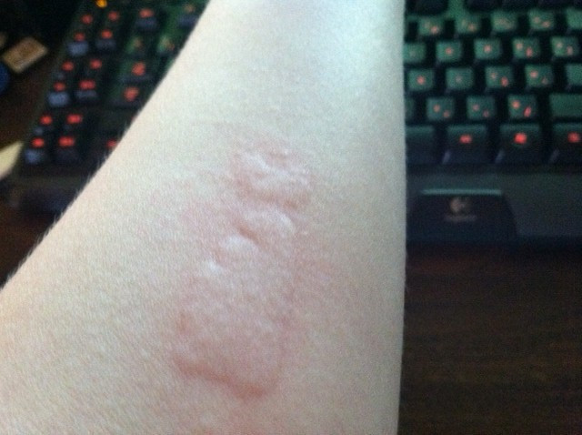 Bu nasıl akım! Vücutlarını delik deşik ediyorlar tuz ve buz... - Resim: 2