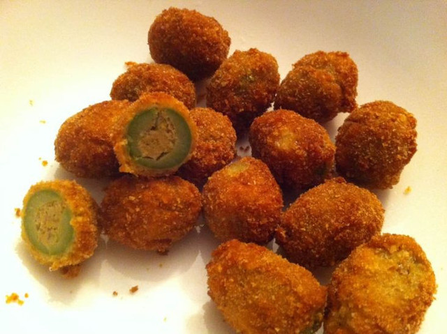 İnanılmaz! 60 yaşındaki kadın, beyin ameliyatı sırasında zeytin dolması yaptı - Resim: 1