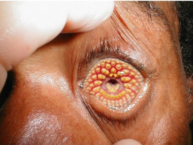 Montaj değil gerçek! Her organı bu hale geliyor korkunç - Resim: 1