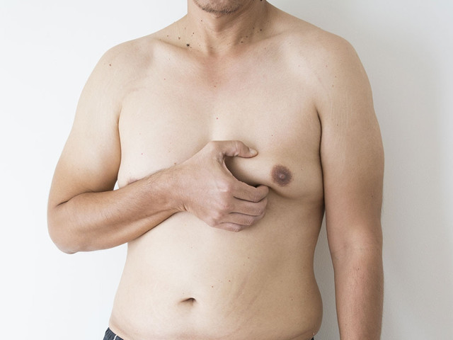 Meme küçültme Karadeniz'de en çok yapılan ikinci ameliyat! - Resim: 1