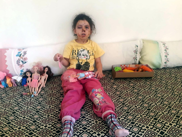 İzmir'de konvoy sözde yasak! Minik Neriman'ı havaya ateş ederek bu hale getirdiler! - Resim: 0