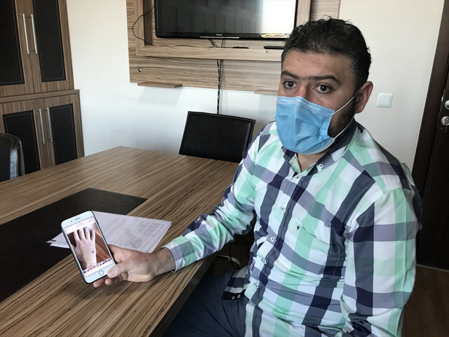 Sokak köpeklerinin ısırdığı adama belediye 3 bin lira tazminat ödeyecek - Resim: 2