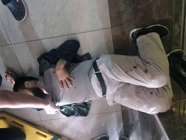 Asansör 11'inci kattan düştü: Mucize kurtuluş - Resim: 0