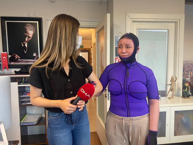 'Sana hediye aldım' deyip gösterdi! Tekirdağ'da eşinin yaktığı kadın ilk kez konuştu - Resim: 0