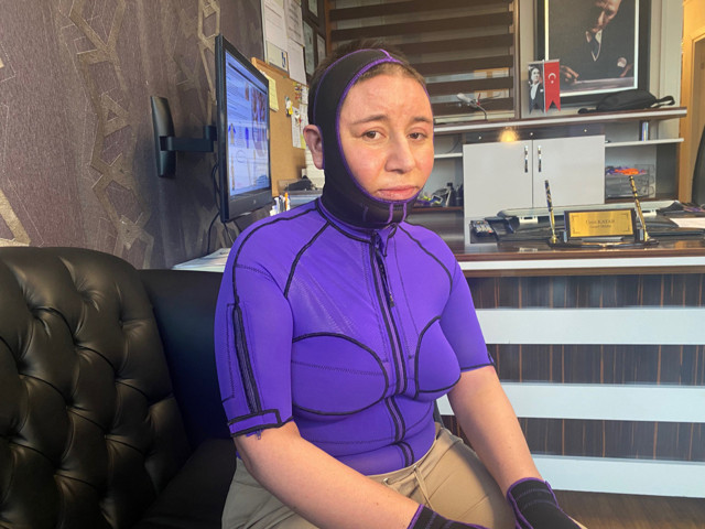 'Sana hediye aldım' deyip gösterdi! Tekirdağ'da eşinin yaktığı kadın ilk kez konuştu - Resim: 2