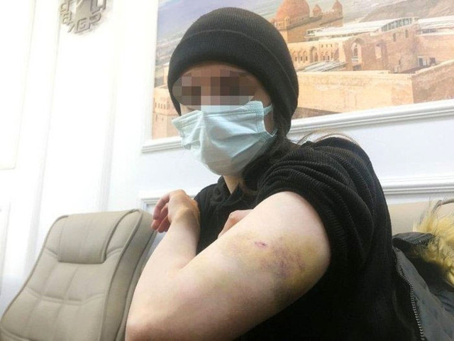 Rezidansta genç kıza işkence! İddianame hazırlandı istenen cezalar belli oldu - Resim: 1