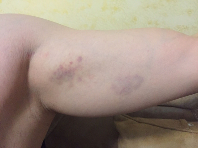 Eski özel harekatçı, polise yumruk attı! Karakolda 'işkence' iddiası - Resim: 1