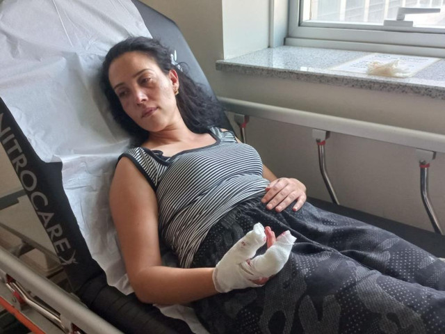 Konuşmak için çağırdığı eşine işkence edip, parmağını kesmeye çalıştı! Cani koca tutuklandı - Resim: 1