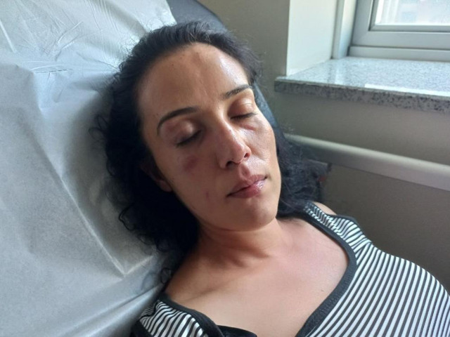 Konuşmak için çağırdığı eşine işkence edip, parmağını kesmeye çalıştı! Cani koca tutuklandı - Resim: 3