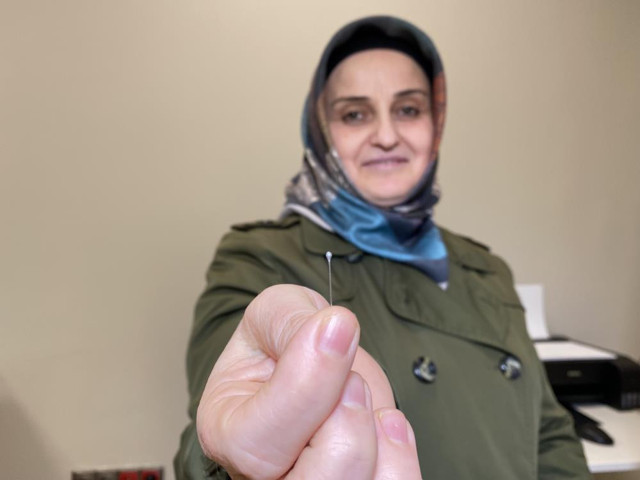 İki çocuk annesi hapşırınca yuttu! Yaklaşık 3,5 santim midesinden çıkarıldı - Resim: 4