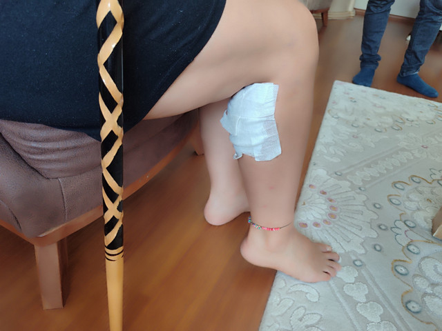 Kadına yavaş yavaş yaklaştı, tek ısırıkta bacağını parçaladı! 'Sevdirmeye geliyor sandım' - Resim: 2