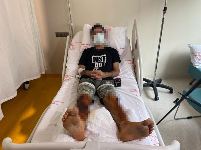 Lavabo açıcı bomba gibi patladı, vücudunun yüzde 35'i yandı - Resim: 1