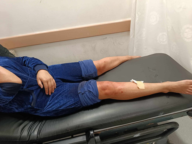 Hatay'da sahipsiz köpeklerin saldırısına uğrayan kadın yaralandı - Resim: 0