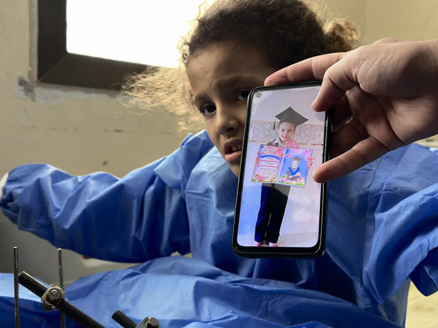 Sağ bacağını kaybetti sol bacağı da tehlikede Filistinli kızın yardım çığlığı - Resim: 0