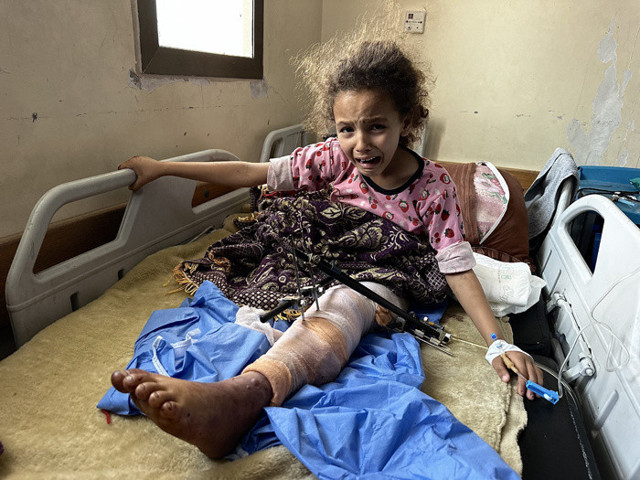 Sağ bacağını kaybetti sol bacağı da tehlikede Filistinli kızın yardım çığlığı - Resim: 1