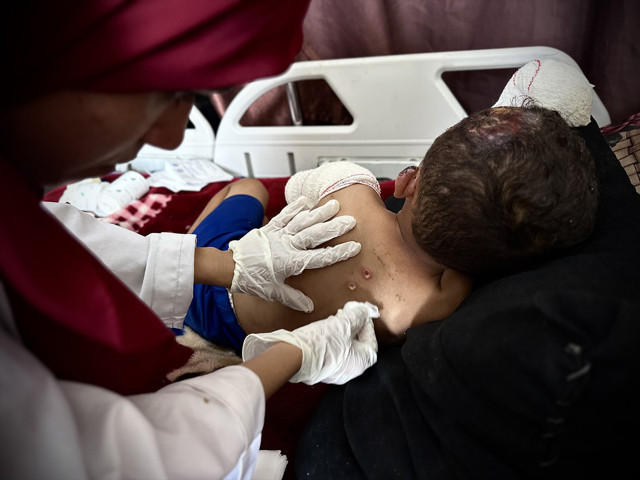 Gazzeli Ahmed, İsrail'in saldırısında hem yaralandı hem de yetim ve öksüz kaldı - Resim: 0